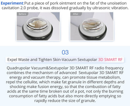 Shape Tactics 6-in-1 Unoisetion Cavitation 2.0 Vacuum RF System - Renee Lane Company