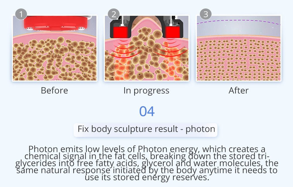 Shape Tactics 6-in-1 Unoisetion Cavitation 2.0 Vacuum RF System - Renee Lane Company