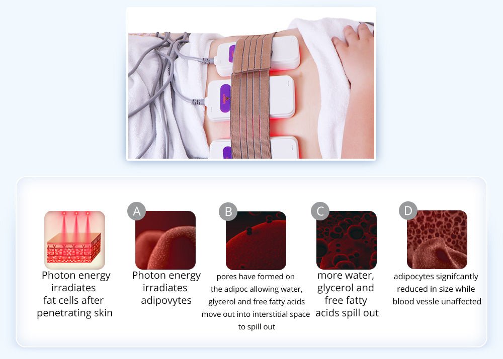 Shape Tactics 6-in-1 Unoisetion Cavitation 2.0 Vacuum RF System - Renee Lane Company