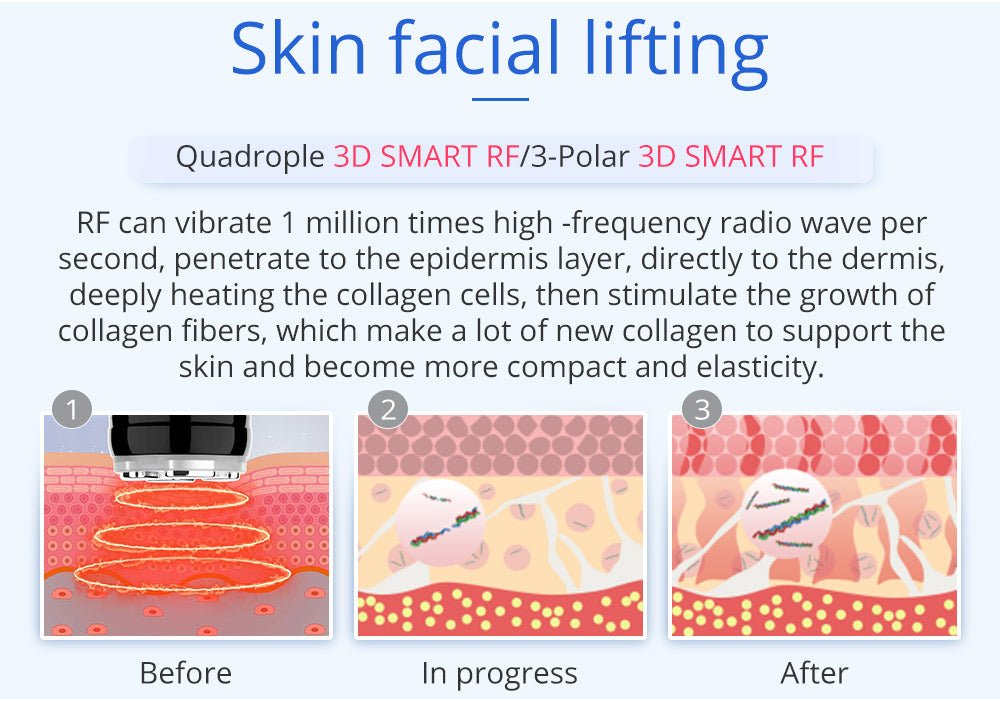 Shape Tactics 6-in-1 Unoisetion Cavitation 2.0 Vacuum RF System - Renee Lane Company