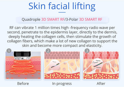 Shape Tactics 6-in-1 Unoisetion Cavitation 2.0 Vacuum RF System - Renee Lane Company