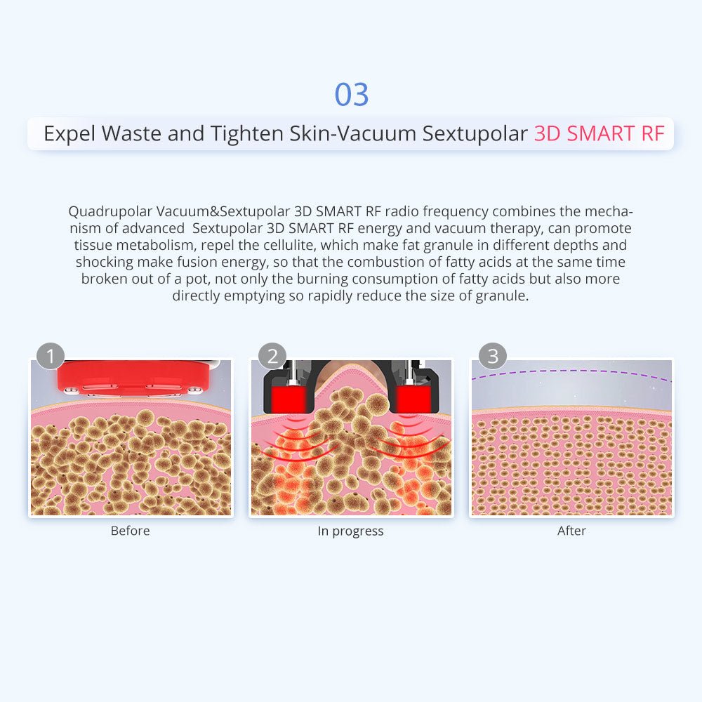 Shape Tactics 6-in-1 Unoisetion Cavitation RF 160mW System - Renee Lane Company