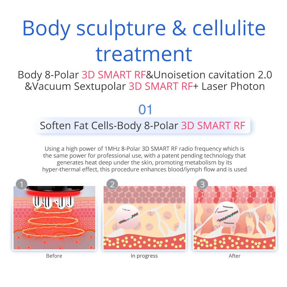 Shape Tactics 7-in-1 40K Ultrasonic Cavitation & RF Hot-Cold Therapy System - Renee Lane Company