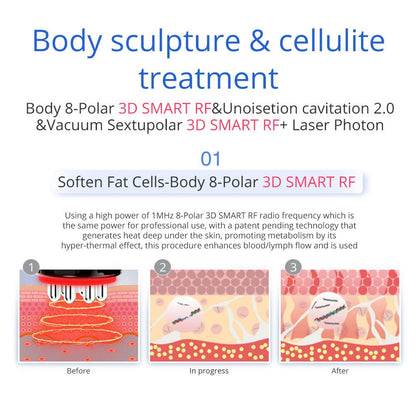 Shape Tactics 7-in-1 40K Ultrasonic Cavitation & RF Hot-Cold Therapy System - Renee Lane Company