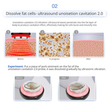 Shape Tactics 7-in-1 40K Ultrasonic Cavitation & RF Hot-Cold Therapy System - Renee Lane Company