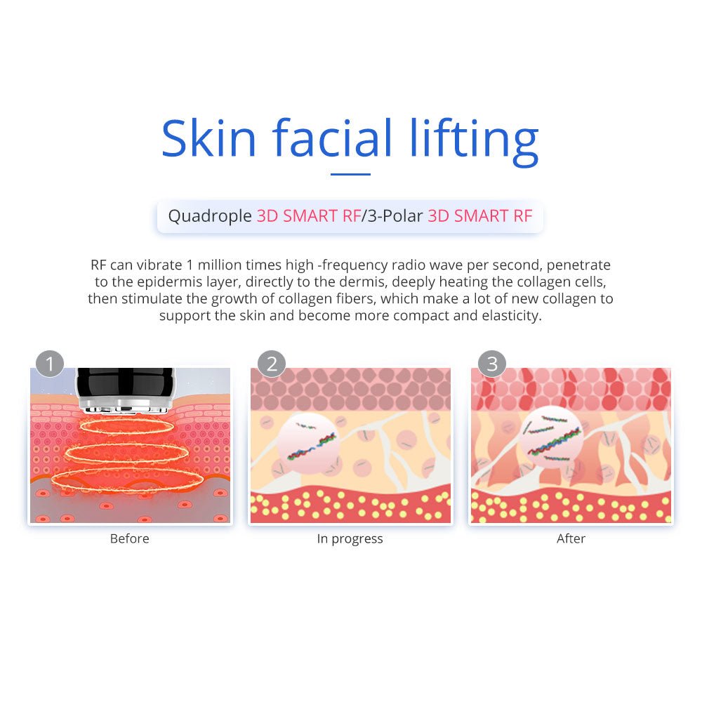 Shape Tactics 7-in-1 40K Ultrasonic Cavitation & RF Hot-Cold Therapy System - Renee Lane Company