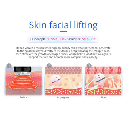 Shape Tactics 7-in-1 40K Ultrasonic Cavitation & RF Hot-Cold Therapy System - Renee Lane Company
