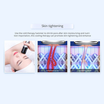 Shape Tactics 7-in-1 40K Ultrasonic Cavitation & RF Hot-Cold Therapy System - Renee Lane Company