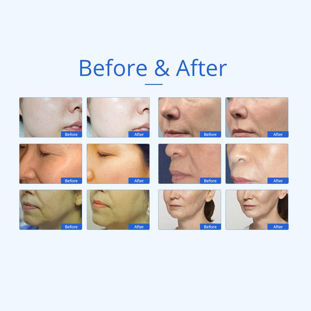 Shape Tactics 7-in-1 40K Ultrasonic Cavitation & RF Hot-Cold Therapy System - Renee Lane Company