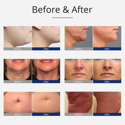 Shape Tactics 8-in-1 Cavitation RF Bio Hot and Cold Therapy System - Renee Lane Company