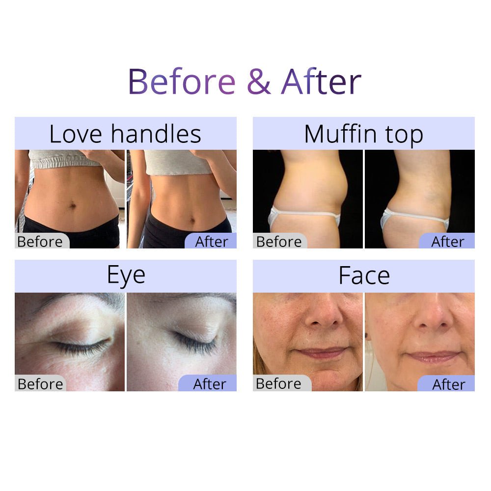 Shape Tactics 8-in-1 Cavitation RF Body Sculpting System - Renee Lane Company