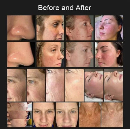 Shape Tactics 8-in-1 Hot & Cold Fusion Plasma Facial Beauty System - Renee Lane Company