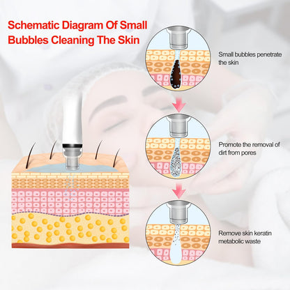 Shape Tactics 8-in-1 Hydro Dermabrasion & Skin Analysis System - Renee Lane Company