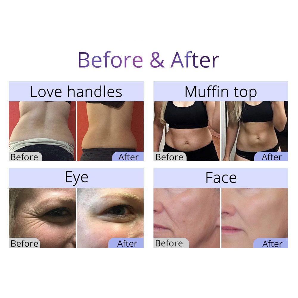 Shape Tactics 8-in-1 RF Cavitation Sculpt System - Renee Lane Company