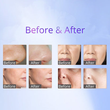 Shape Tactics 8-in-1 RF Skin Tightening System with Hot & Cold Hammer and BIO Therapy - Renee Lane Company