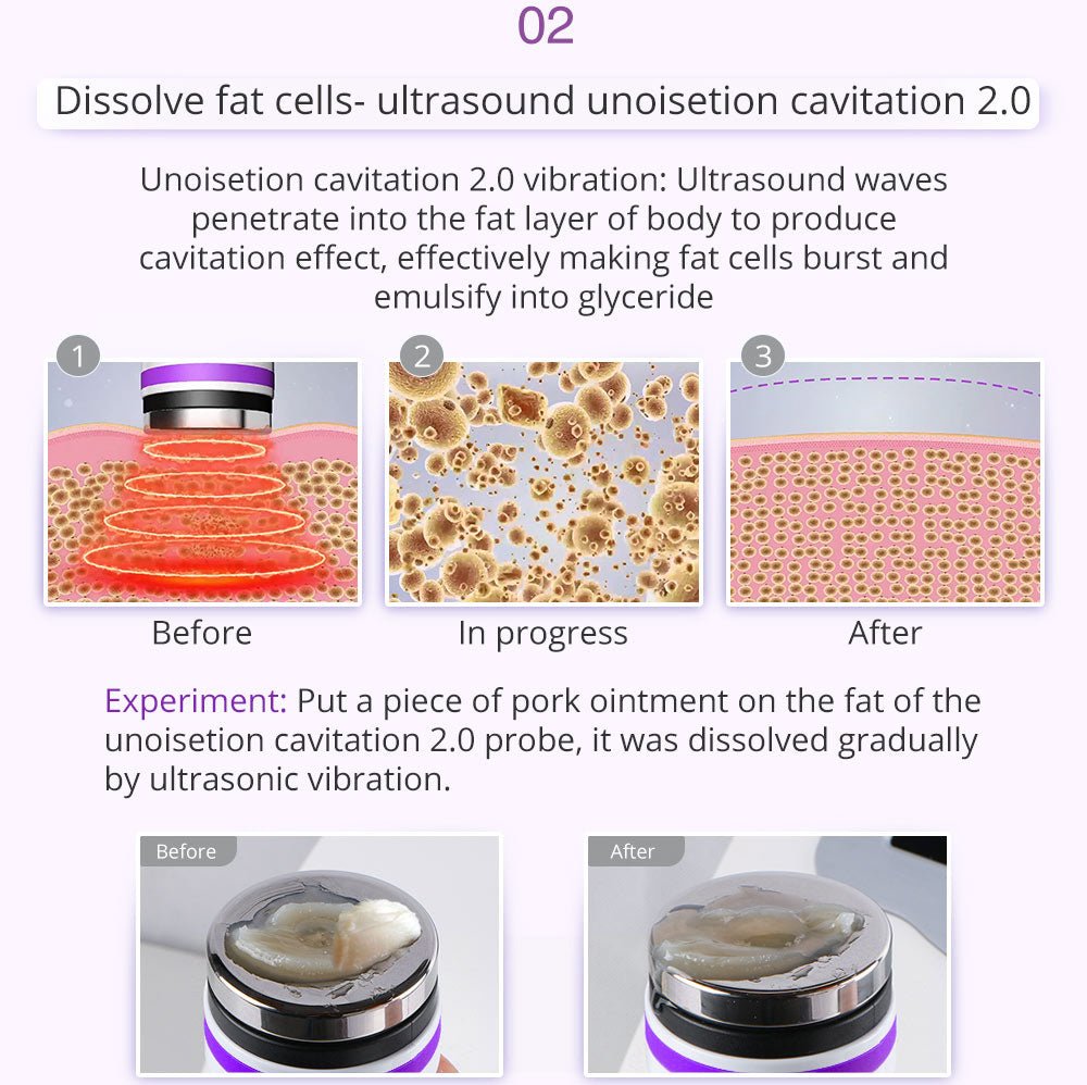Shape Tactics 9-in-1 Lipo Microcurrent Photon Ultrasonic Cavitation System - Renee Lane Company