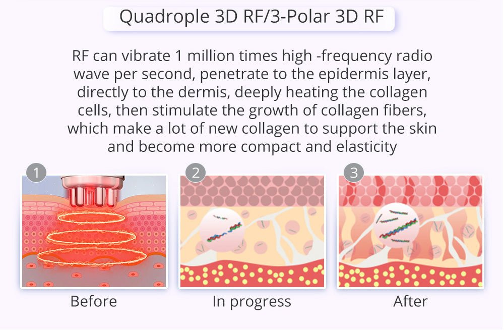 Shape Tactics 9-in-1 Lipo Microcurrent Photon Ultrasonic Cavitation System - Renee Lane Company