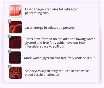 Shape Tactics 9-in-1 Lipo Microcurrent Photon Ultrasonic Cavitation System - Renee Lane Company