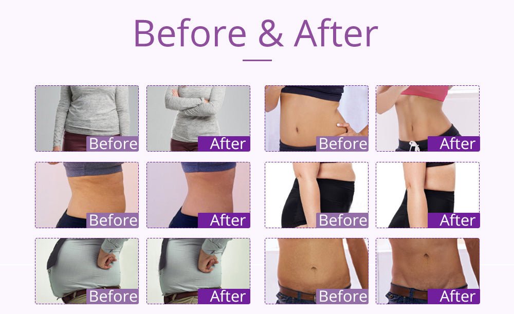 Shape Tactics 9-in-1 Lipo Microcurrent Photon Ultrasonic Cavitation System - Renee Lane Company