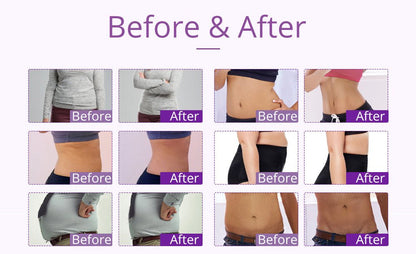 Shape Tactics 9-in-1 Lipo Microcurrent Photon Ultrasonic Cavitation System - Renee Lane Company