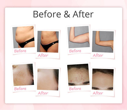 Shape Tactics 9-in-1 Unoisetion Cavitation RF Vacuum Bio Photon System - Renee Lane Company