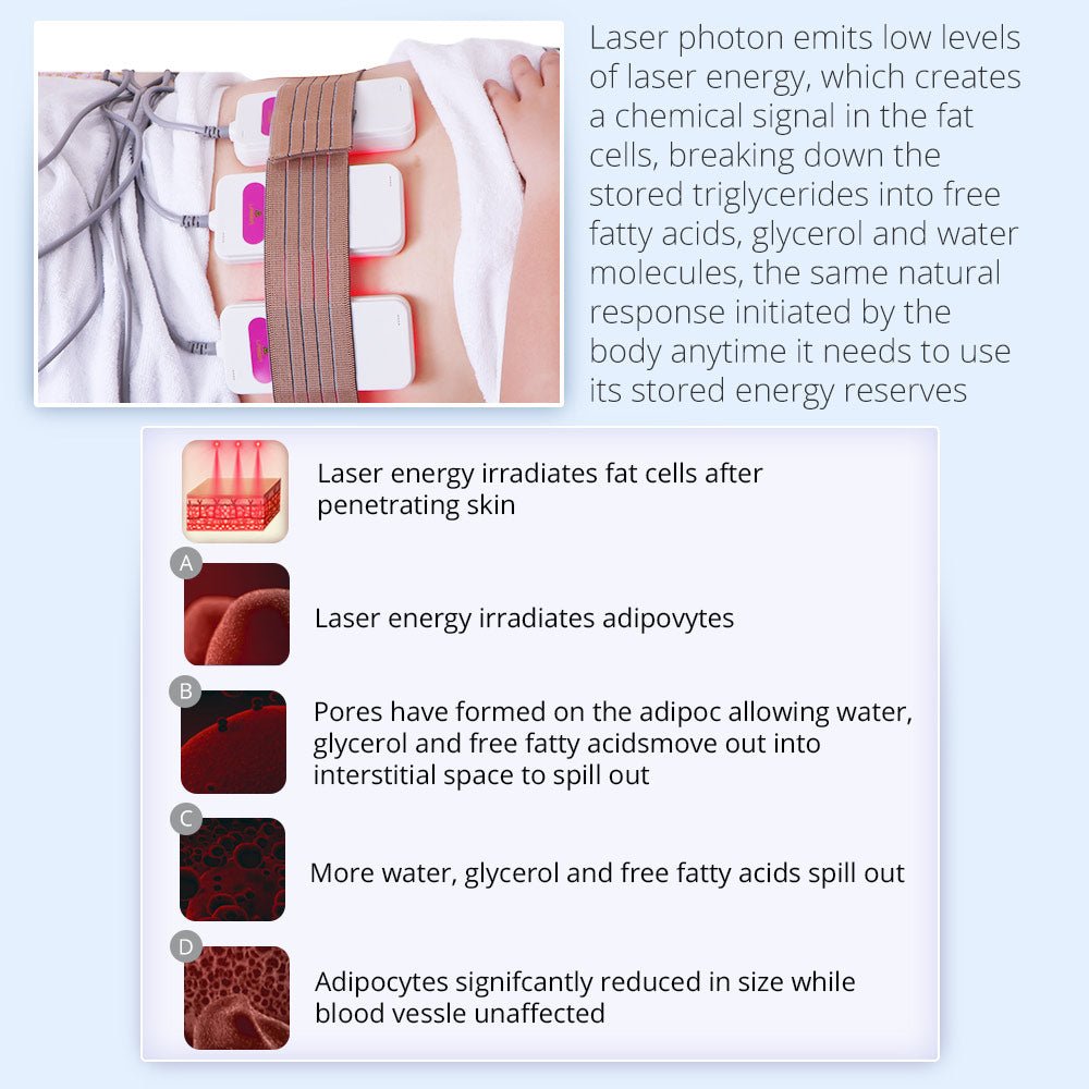 Shape Tactics Advanced 5-in-1 Cryolipolysis 40K Cavitation RF Lipo Laser System - Renee Lane Company