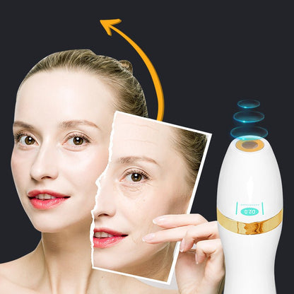 Shape Tactics Advanced 7D HIFU Skin Care System - Renee Lane Company