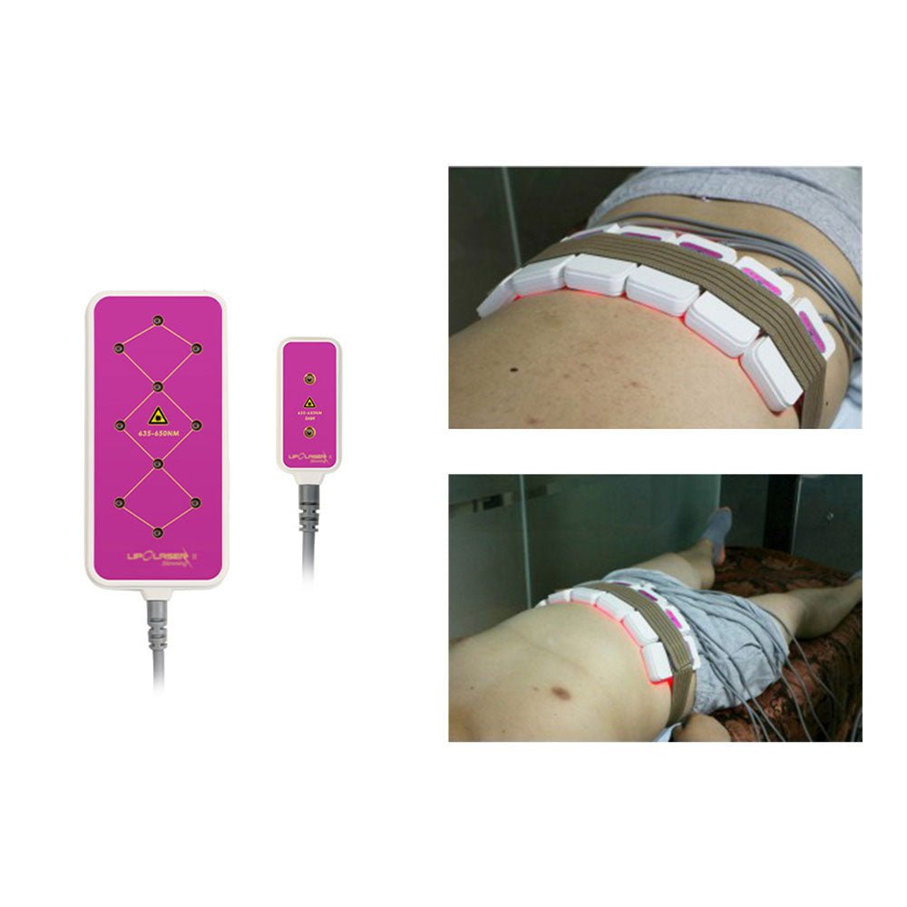 Shape Tactics Advanced 8-Pad 160mW Lipo Laser System - Renee Lane Company