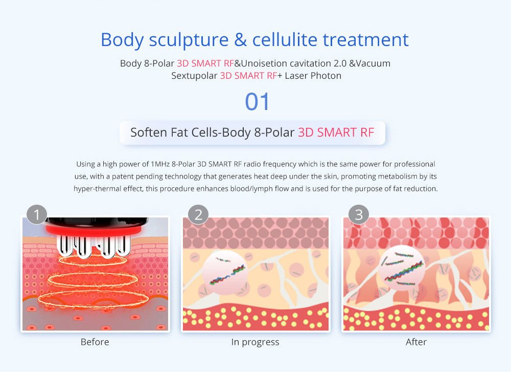 Shape Tactics Advanced 8-in-1 Unoisetion Cavitation & RF System with LED Laser Pads - Renee Lane Company