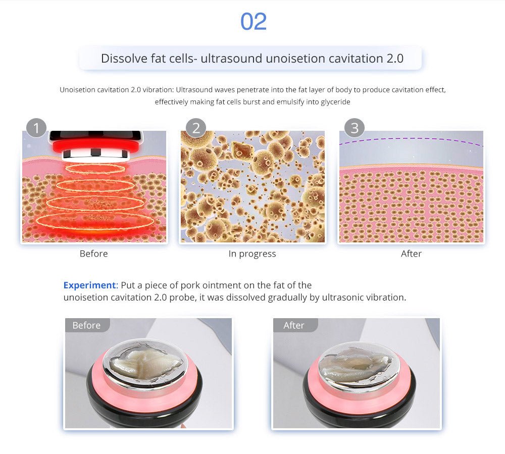 Shape Tactics Advanced 8-in-1 Unoisetion Cavitation & RF System with LED Laser Pads - Renee Lane Company