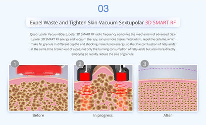 Shape Tactics Advanced 8-in-1 Unoisetion Cavitation & RF System with LED Laser Pads - Renee Lane Company