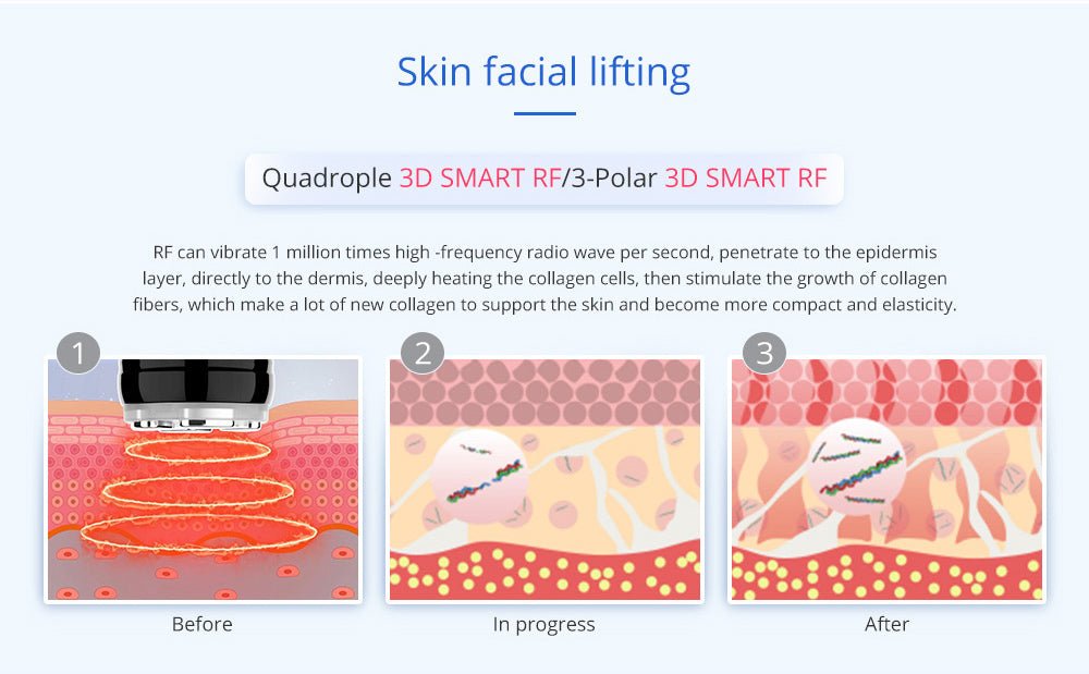 Shape Tactics Advanced 8-in-1 Unoisetion Cavitation & RF System with LED Laser Pads - Renee Lane Company