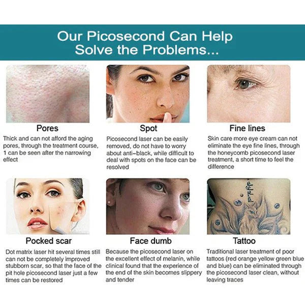 Shape Tactics Advanced Multi-Wavelength Picosecond Laser System - Renee Lane Company