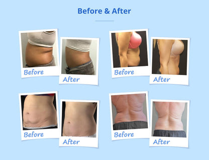 Shape Tactics Advanced Stand-Up Cooling Contouring System - Renee Lane Company
