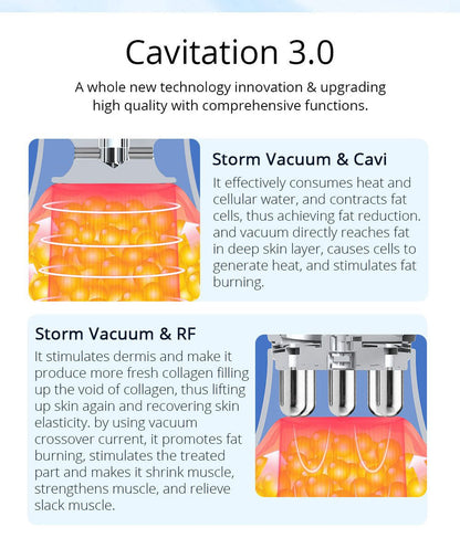 Shape Tactics CaVstorm Cavitation RF System - Renee Lane Company