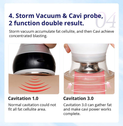 Shape Tactics CaVstorm Cavitation RF System - Renee Lane Company