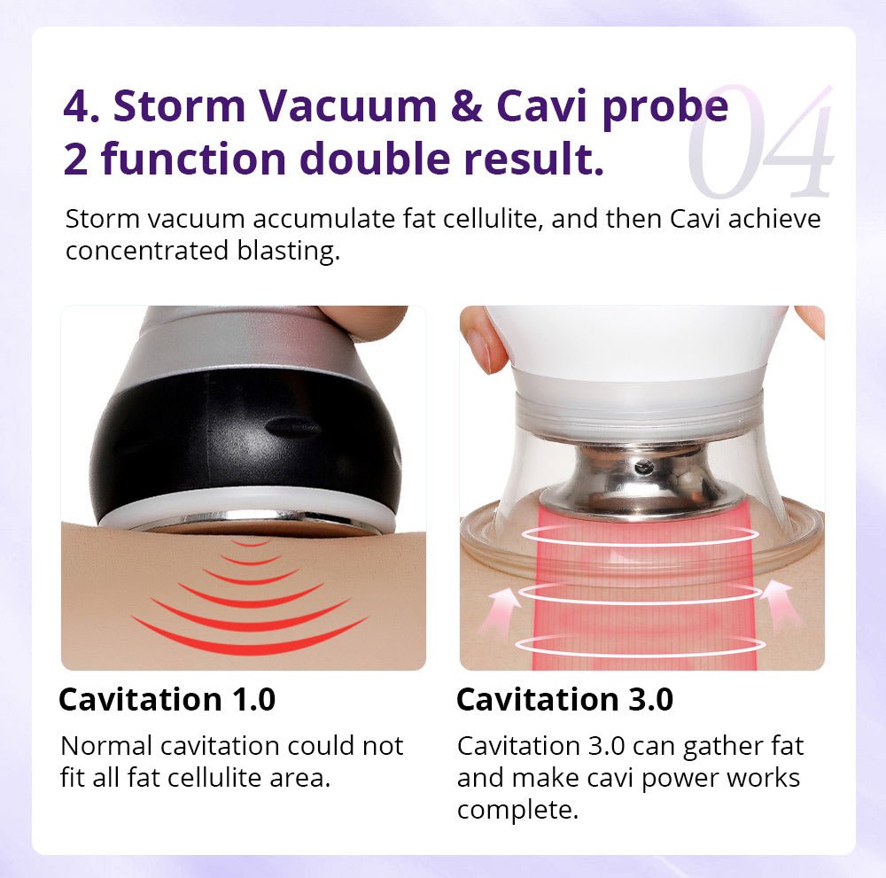 Shape Tactics Cavstorm 40K Cavitation 3.0 with Microcurrent RF System - Renee Lane Company