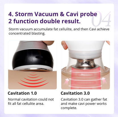 Shape Tactics Cavstorm 40K Cavitation 3.0 with Microcurrent RF System - Renee Lane Company