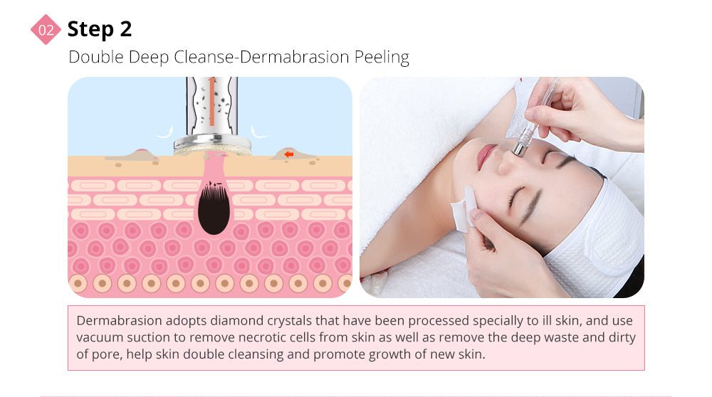 Shape Tactics Diamond Dermabrasion & Ultrasonic Skin Care System - Renee Lane Company