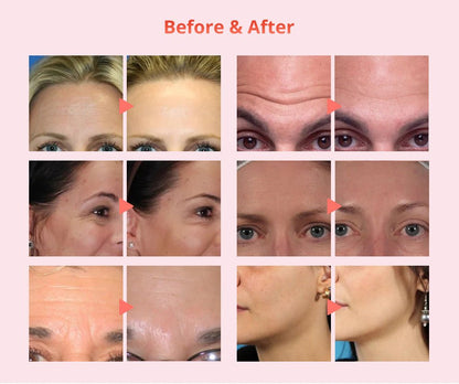 Shape Tactics Diamond Dermabrasion & Ultrasonic Skin Care System - Renee Lane Company
