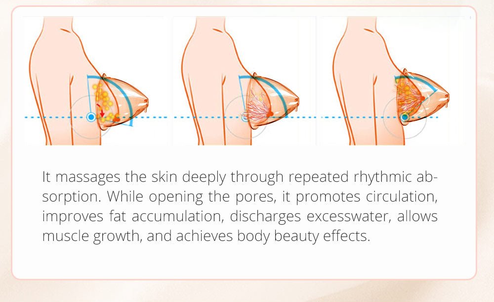 Shape Tactics EMS Vacuum Cupping Body Contouring System - Renee Lane Company