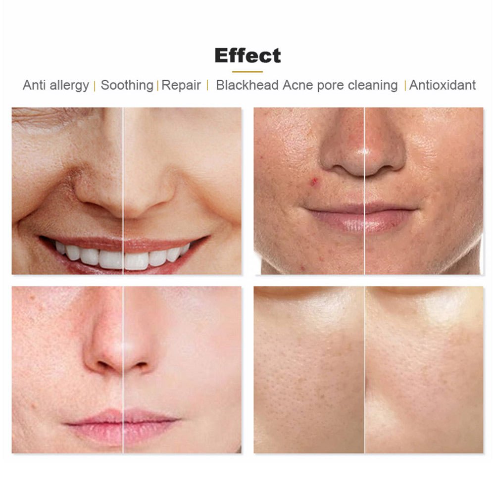 Shape Tactics Hydroge Pro Oxygen Skin Rejuvenation System - Renee Lane Company
