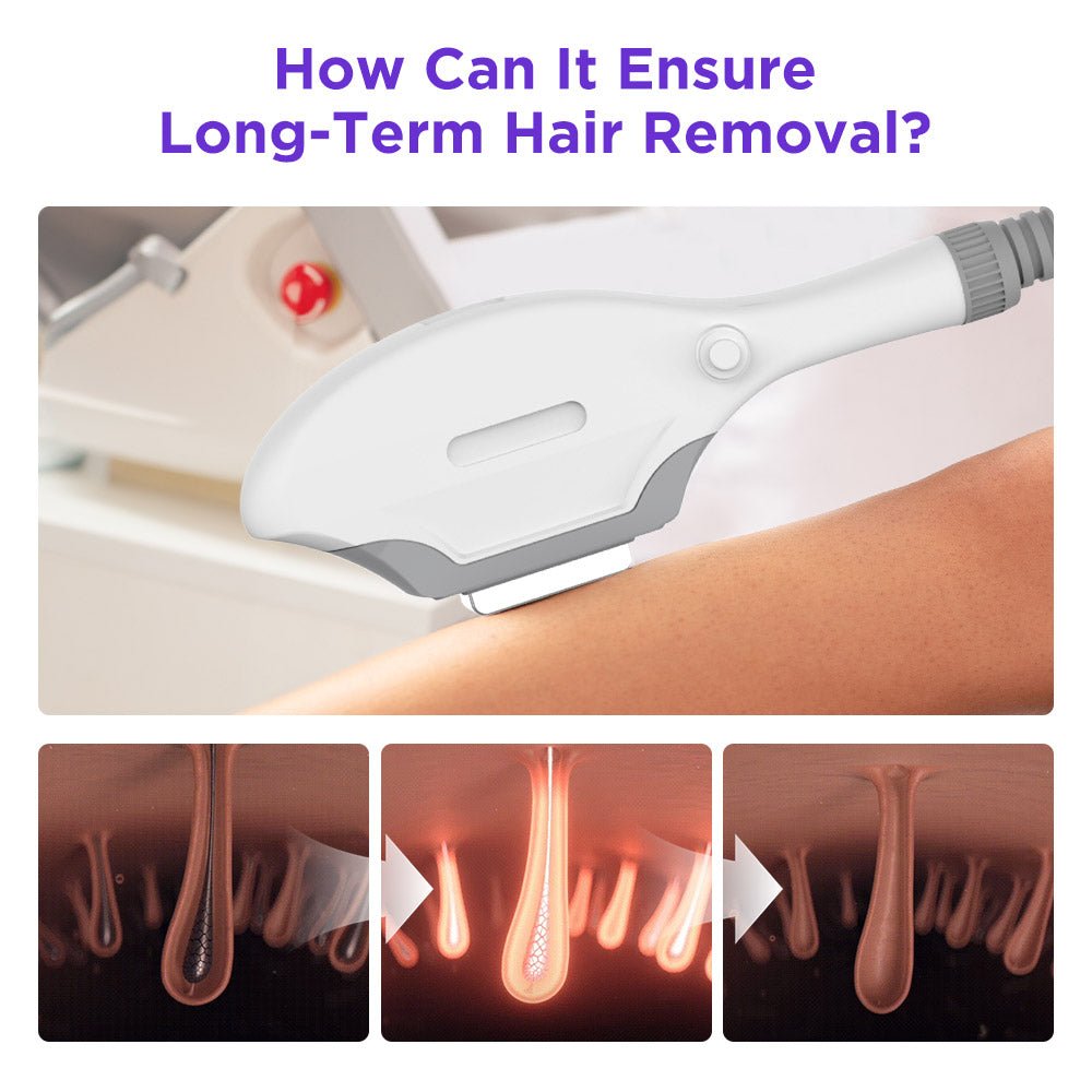 Shape Tactics IPL Hair Removal and Skin Rejuvenation System - Renee Lane Company