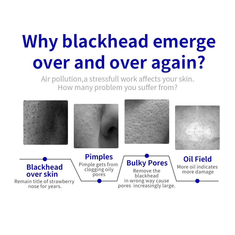 Shape Tactics Microdermabrasion Vacuum Spray for Deep Facial Exfoliation - Renee Lane Company