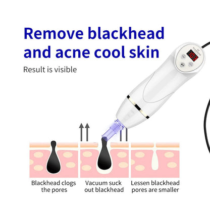 Shape Tactics Microdermabrasion Vacuum Spray for Deep Facial Exfoliation - Renee Lane Company