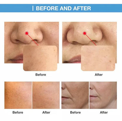 Shape Tactics O+ Skin Care Oxygen CO2 & RF Beauty System - Renee Lane Company