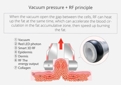 Shape Tactics Portable 6-in-1 Cavitation RF Vacuum Lipo Laser System - Renee Lane Company