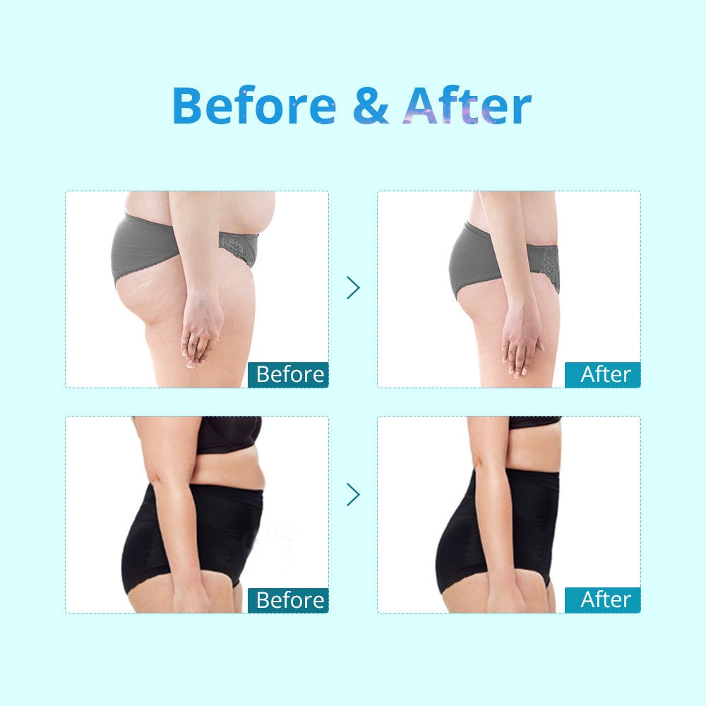 Shape Tactics Portable Double-Handle Cryolipolysis Contouring System - Renee Lane Company