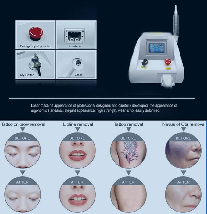 Shape Tactics Precision Picosecond Laser System - Renee Lane Company