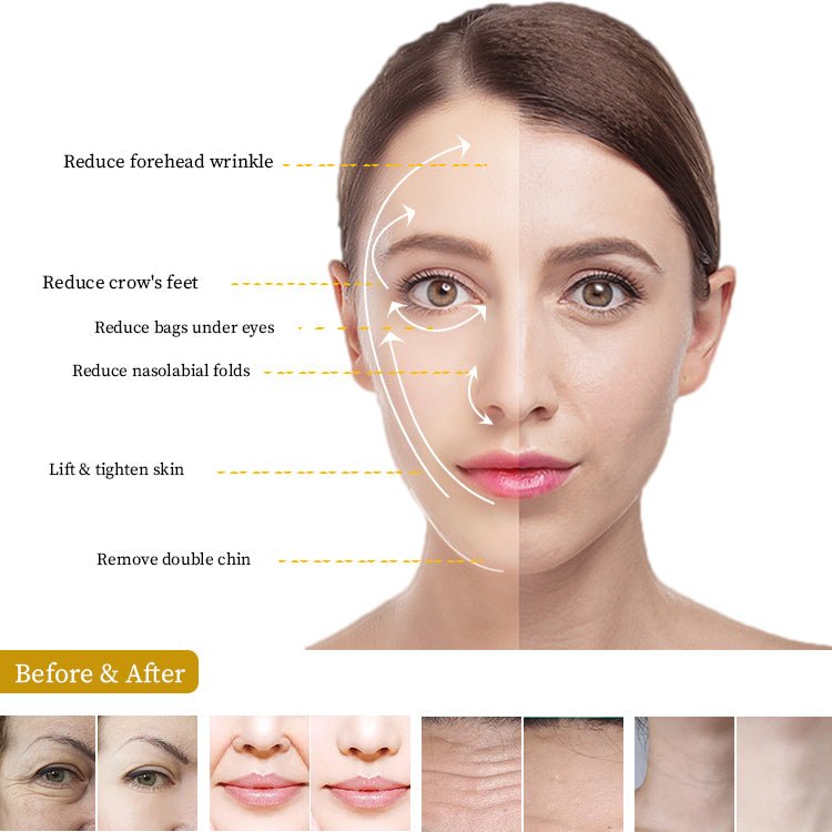 Shape Tactics Pro 7D HIFU System - Renee Lane Company